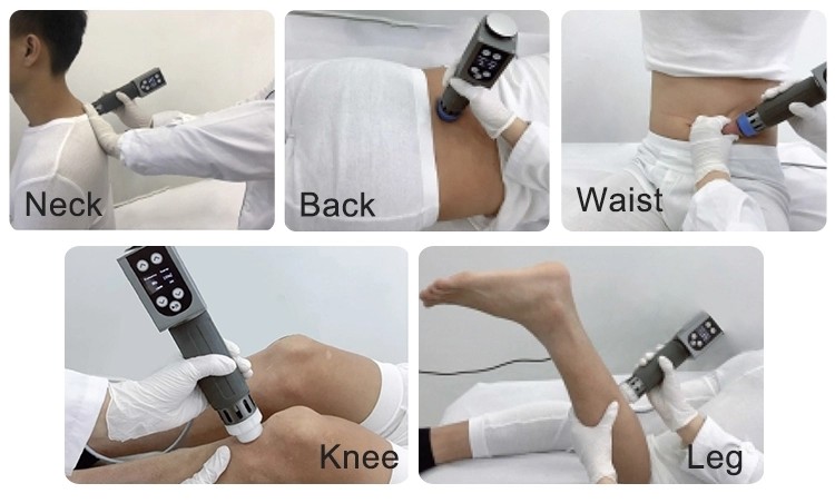 200mj Radial Shockwave Therapy Machine For Tennis Elbow And Joints Pain