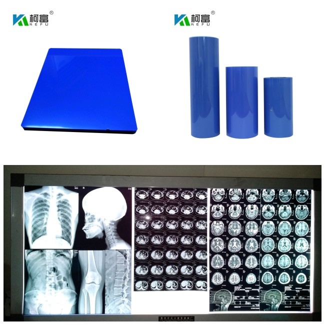 High Resolution Inkjet X Ray Film Glossy Surface Finish 8*10 10x12 10*14 11*14 13*17 14*17Sheets Size