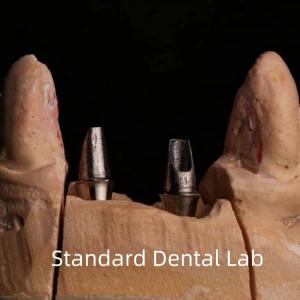 Quality Dental Porcelain Zirconia Implant Crown Professional High Esthetics wholesale