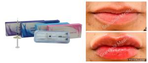 Quality Injectable Hyaluronic Acid Gel For Wrinkles Knee Injections Eyes Wrinkles Neck Lines wholesale