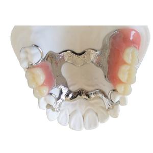 Quality OEM 3D Printer PFM Dental Crown Bridge High Biological Intermiscibility wholesale