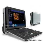 Hospital 4D Fetal doppler Ultrasound Scanner