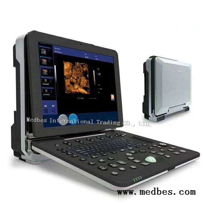 Medical Diagnostic Ultrasounic Machine Hospital Fetal doppler Ultrasound Scanner