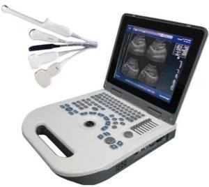 Quality OEM OB Obstetric Ultrasound Equipment LCD Display TGC Control wholesale