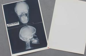 Quality White Medical Paper Chest X Ray Film Waterproof High Sharpness wholesale