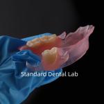 High Esthetics Dental TCS Valplast Flexible Partial Dentures Dental Lab pink