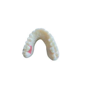 Quality Digital Oral Scanning PFM Dental Crowns Bridge Implantology Demands wholesale
