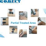 Focused Shockwave Therapy Machine 150W Electromagnetic Therapy Machine