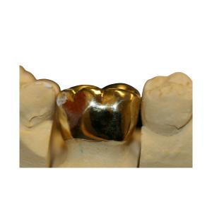Quality High Density Fine Protection FMC Crown Bridge Dental Laboratory wholesale