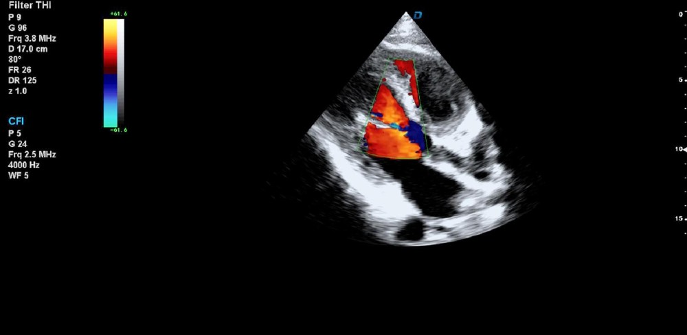 New arrival DW-T8 Elastography trolley ultrasonic scanner 4D cardiac color doppler ultrasound with TDI
