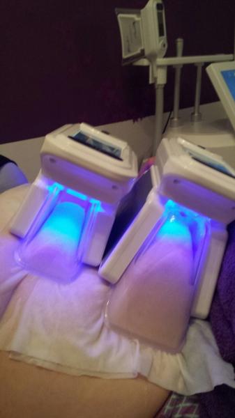 Vacuum Cellulite Therapy Body Slimming Cryolipolisis Slimming Machine Fat