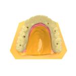 Dental Bridge Photosensitive Resin Lightweight Temporary Crown Resin