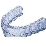 Simple Install Invisible Fixed Orthodontic Treatment for Dentist Research