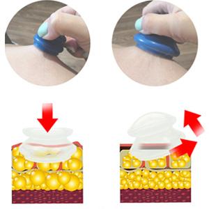 Cupping Therapy Sets