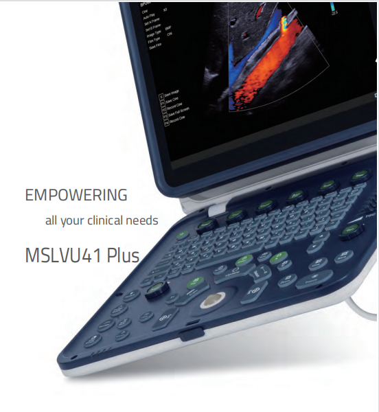 Color Doppler Portable Ultrasound Machine Medical USG PW CW DICOM Cardiac Probe Cardiology for Hospital Clinic