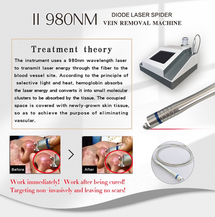 spider veins vascular vein removal nail fungus 980nm diode laser therapy machine for toe nail fungus treatment