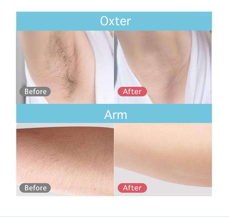 Hot selling 999999 flashes IPL Hair Removal Epilator with LED screen Permanent Hair Removal instrument For Home use