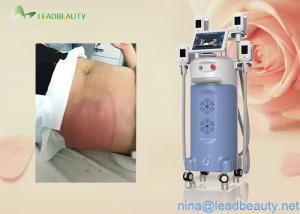 Quality Great weight loss 0kpa-100kpa Vacuum machine cryolipolysis wholesale