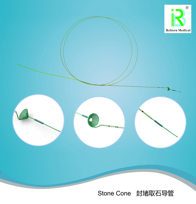 Green Stone Cone Prevents Stone Migration Improved Prevention Retropulsion