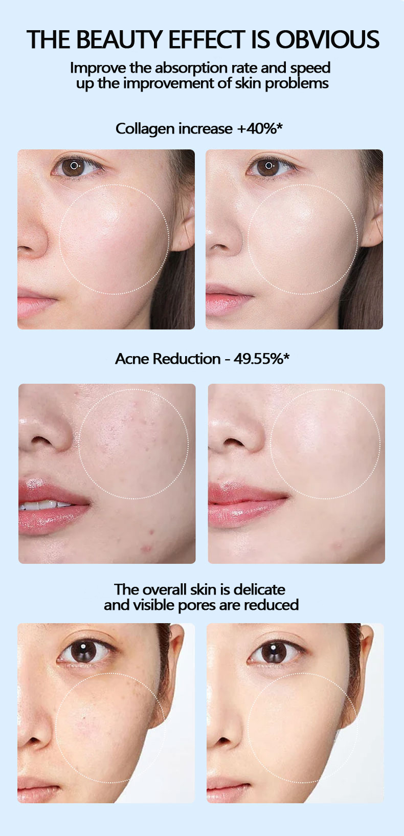 DC5V Auto Digital Derma Pen Microneedling Pen For Home Use