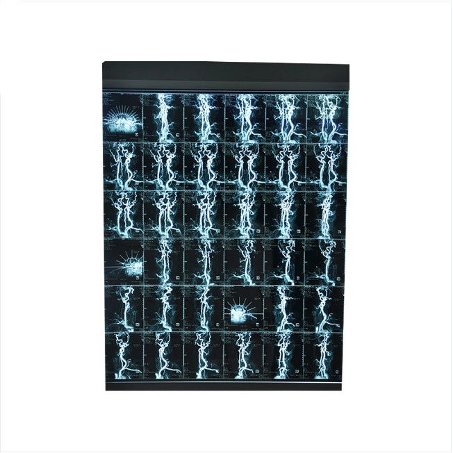 High Resolution Inkjet X Ray Film Glossy Surface Finish 8*10 10x12 10*14 11*14 13*17 14*17Sheets Size