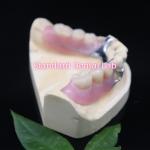 Acrylic Metal Partial Denture Frameworks High Esthetics SDL dental lab