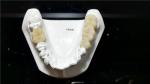 Ceramic Dental Crown,Zirconia Dental Crowns