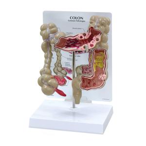 Quality Advanced Medical Human Large Intestine Anatomy Model For School Hospital wholesale