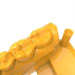 Orange Yellow Dental 3d Resin Planting Model Photosensitive Resin