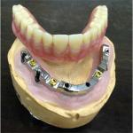 High Biological Inter Miscibility Denture Dental Lab Safety Implant