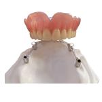 COCR Tooth Implant Crown FDA Dental Implants With Titanium Bar