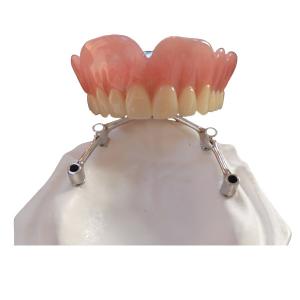 Quality COCR Tooth Implant Crown FDA Dental Implants With Titanium Bar wholesale