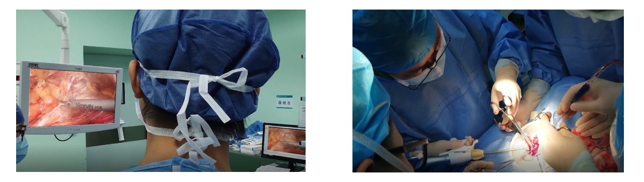 Utrasonic Scalpel applications