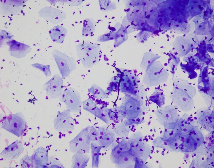 Stable Liu's Stain For Auto Stainer Baso Clear Colourful Medical Stains