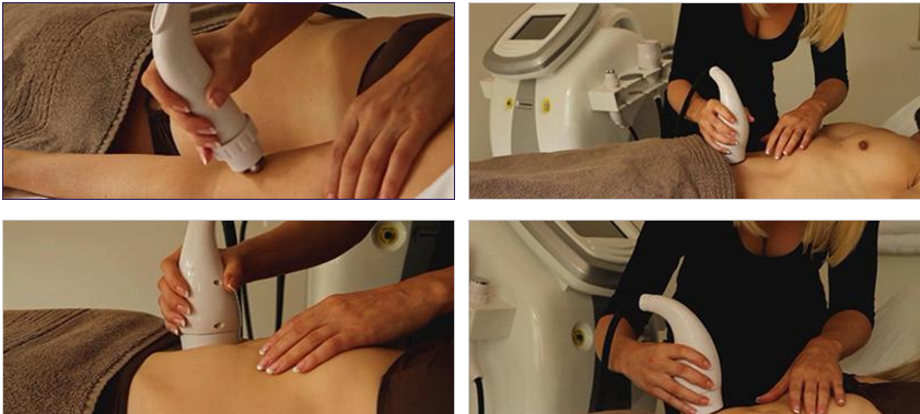 Radio Frequency Face Lifting Machine 28khz 33khz 40khz Cellulite Massager Body Sculpting Machine