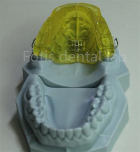 Quality Customizable Orthodontic Retainer for China Dental Lab wholesale
