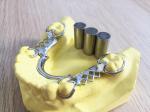 High Intensity Cobalt Iron Alloy , Metal Alloy Used For Dental Fillings 45%