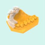 Biocompatible Surgical Resin Accurate Surgical Guide Resin Dental Implant