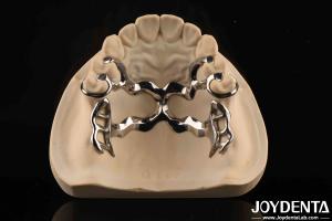 Quality Alloying Metal Materials Dental Framework Suppleness for Oral Health Practitioners wholesale