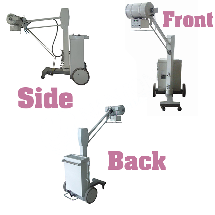 Portable x-ray equipment with 100mA