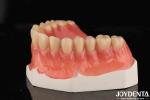 Acrylic Teeth Finish Lightweight Resin Material Dental Restorations Tooth