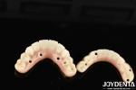 High Durability Ti-Bar Zirconia Hybrid Bridge The Ultimate Choice for Achieving