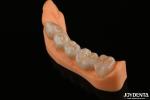 Precision Dental Restorations Full Zirconia High Flexural Strength Natural Color
