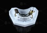 Corrosion Resistant Printed Titanium Framework Sensitive Skin