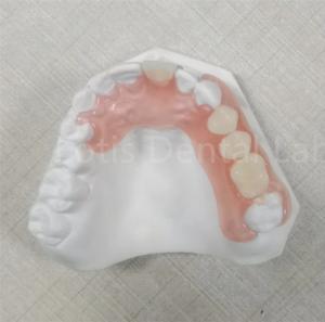 Quality Pink / Transparent TCS Valplast Odor Resistant Flexible Dental Prosthesis wholesale