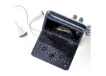 Mobility Innovative Highlight Portable Ultrasound Scanner With 15 Inch LED