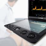 Sonoscape S9 Pregnant Baby Medical Diagnosis 4D Color Doppler Sonography Machine