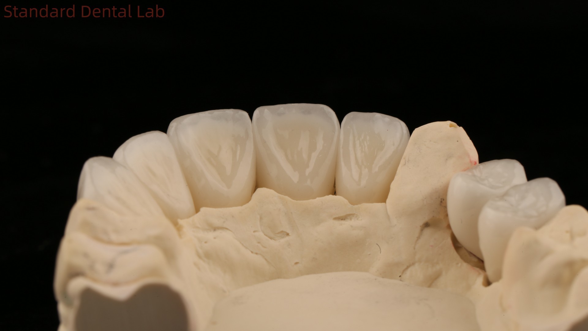 China Dental Lab Zirconia Full Contour Crown High Aesthetic Natural Dental Bridge 5 Year Guarantee
