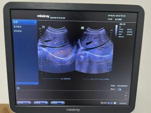 Quality Repair Mindray C5-2E DC-70 Convex OB/GYN Probe C5-2E wholesale