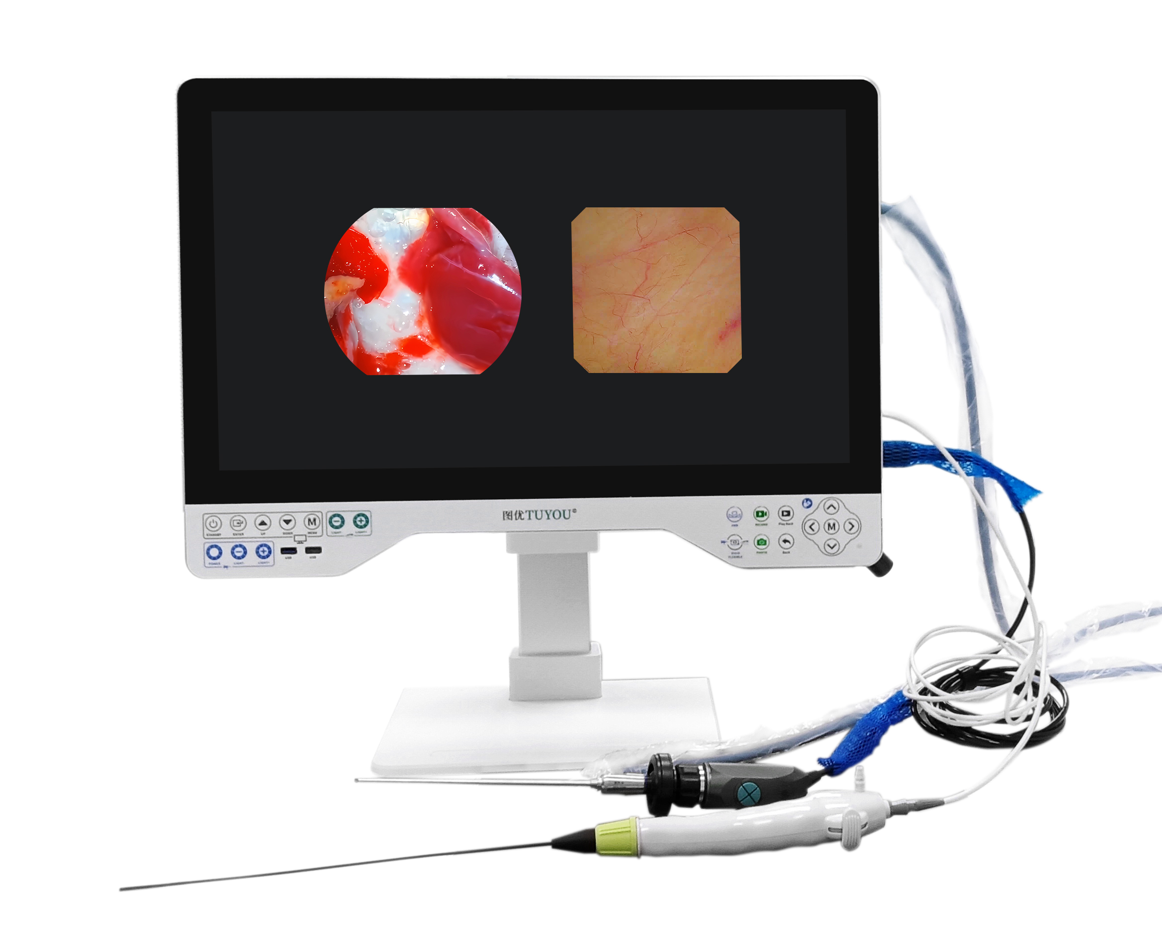 24in TUYOU Nasopharyngoscope Endoscope Camera Recorder For High Definition Laparoscopy Surgeries